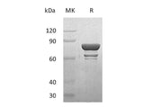 Recombinant Human STAT1 Protein