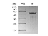 Recombinant Human UBE2A Protein (GST & His Tag)