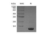 Recombinant Human Neuritin/NRN1 Protein (E.coli, His Tag)