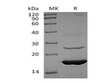 Recombinant Human Ube2L6 Protein (His Tag)