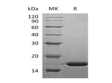 Recombinant Human FABP5 Protein (His Tag)