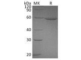 Recombinant Human ALDH3A1 Protein (Human Cells, His Tag)