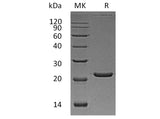 Recombinant Human FTL Protein (His Tag)