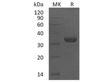 Recombinant Human LMAN2/VIP36 Protein (Human Cells, His Tag)