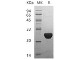 Recombinant Human UBE2T Protein (His Tag)