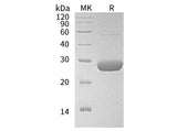 Recombinant Human LYPLA2 Protein (His Tag)