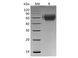 Recombinant Human MICA Protein (His Tag)(Active)