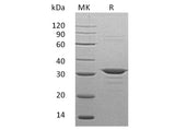 Recombinant Human CLIC4 Protein (His Tag)