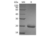 Recombinant Human SECTM1 Protein (His Tag)