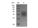 Recombinant Human PTH1R Protein (His Tag)