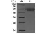 Recombinant Human VSIG4 Protein (His Tag)