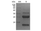 Recombinant Human Kallikrein 6/KLK6 Protein (His Tag)