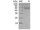 Recombinant Human LSAMP Protein (His Tag)