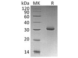 Recombinant Human RGMA Protein (E.coli, His Tag)