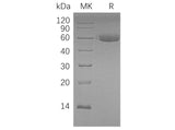 Recombinant Human HAO1 Protein (His Tag)