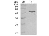 Recombinant Human IDH1 Protein (Human Cells, His Tag)