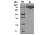 Recombinant Human Butyrylcholinesterase/BCHE Protein (His Tag)