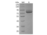 Recombinant Human XPNPEP2 Protein (His Tag)