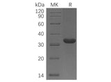 Recombinant Human C1QBP Protein (aa 74-282, His Tag)