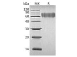 Recombinant Human LYPD3 Protein (His Tag)(Active)