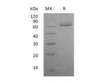 Recombinant Human VNN2 Protein (His Tag)