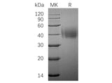 Recombinant Human SLAMF7/CD319 Protein (His Tag)