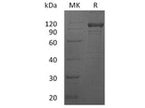 Recombinant Human IL12RB1 Protein (Fc Tag)