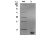 Recombinant Human SPINK4 Protein (His Tag)