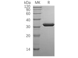 Recombinant Human SULT1A1 Protein (His Tag)