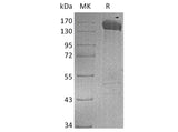 Recombinant Human Jagged 1/JAG1 Protein (Fc Tag)