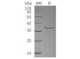 Recombinant Human SULT1B1 Protein (His Tag)