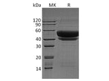 Recombinant Human ST6GAL1 Protein (His Tag)