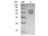 Recombinant Human FCRL1 Protein (His Tag)