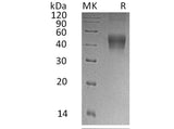 Recombinant Human IL-21R Protein (His Tag)