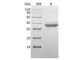 Recombinant Human Chymotrypsin C Protein (His Tag)