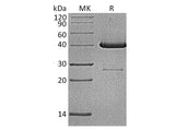 Recombinant Human UBE2D1 Protein (GST Tag)