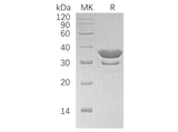 Recombinant Human SULT2A1 Protein (His Tag)