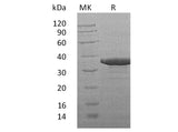 Recombinant Human SULT2B1 Protein (aa 1-311, His Tag)