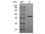 Recombinant Human SULT1A3 Protein (His Tag)