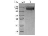 Recombinant Human GPNMB Protein (aa 22-486, His Tag)