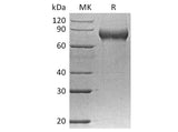 Recombinant Human FLRT2 Protein (His Tag)