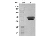 Recombinant Human GPA33 Protein (His Tag)