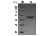 Recombinant Human FOLR1 Protein (His Tag)