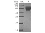 Recombinant Human CD200R1 Protein (His Tag)