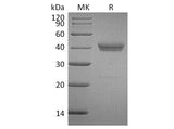 Recombinant Human CADM3 Protein (His Tag)