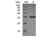 Recombinant Human 15-PGDH Protein (His Tag)