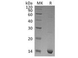 Recombinant Human S100A9 Protein