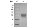 Recombinant Human CD8 beta/CD8B Protein (His Tag)