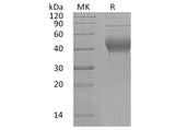 Recombinant Human IL-22BP/IL-22RA2 Protein (His Tag)(Active)