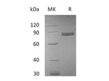 Recombinant Human Transferrin Protein (His Tag)